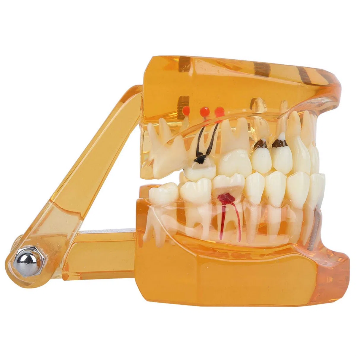 Joyzan Modelo de Dientes, Dientes Naranjas Demostración Color Enfermedad Dental Estudio Removible Diente para Enseñar Cámara Intraoral Material Implante Demostrativo Enseñanza Extraíble Enfermedades
