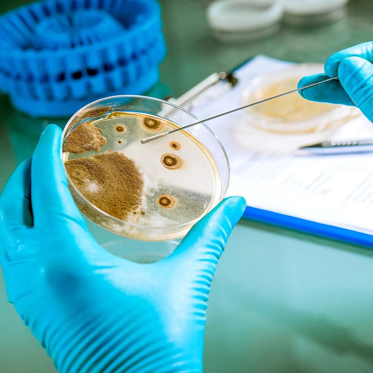 10 Piezas Para Proyectos De Papa Cultivo Prevertido De Siembra De Dextrosa Con Platos De Feria De Ciencias Suministros De Agar Temático De Investigación Biológica