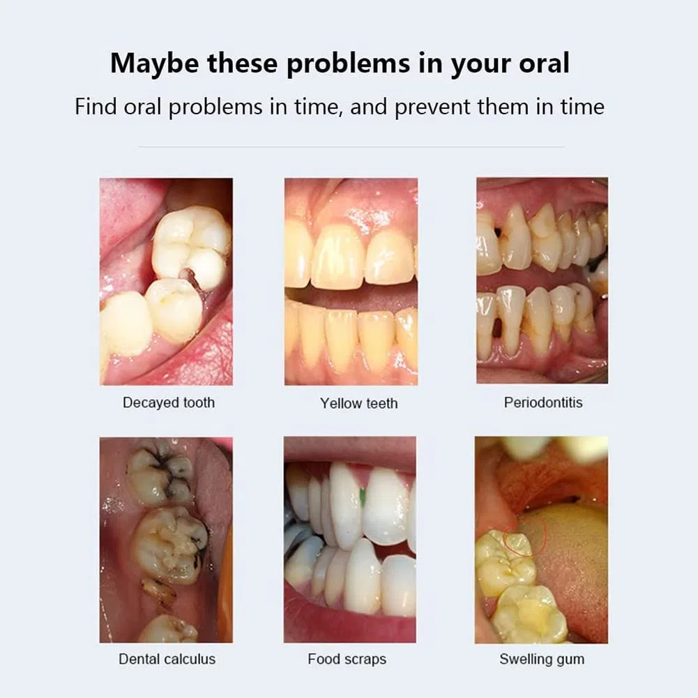 iksvmsis Cámara Intraoral Dental, WiFi Inteligente Cámara Dental, Herramienta De Video Dental para PC iOS Android, Cámara Intraoral De Alta Definición 8 Luces LED para Dentista Dental