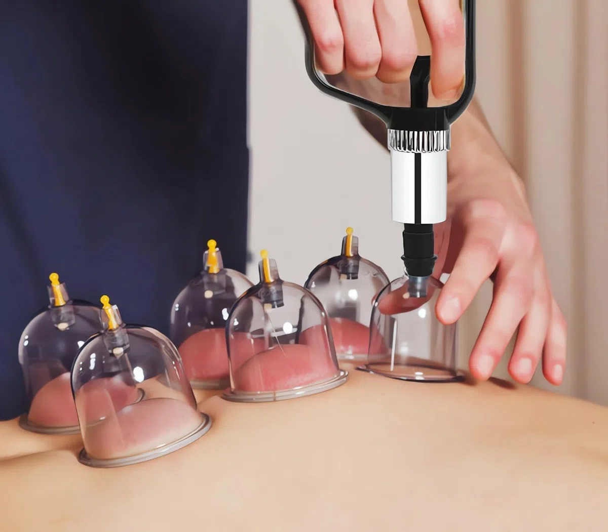 Kit de 16 tazas de succión de hijama, ventosa de masaje- talla V2.0 Insturctions en francés - Ventosas terapéuticas chinas de Cupping Kit de pistola de masaje acupuntura 16 tazas