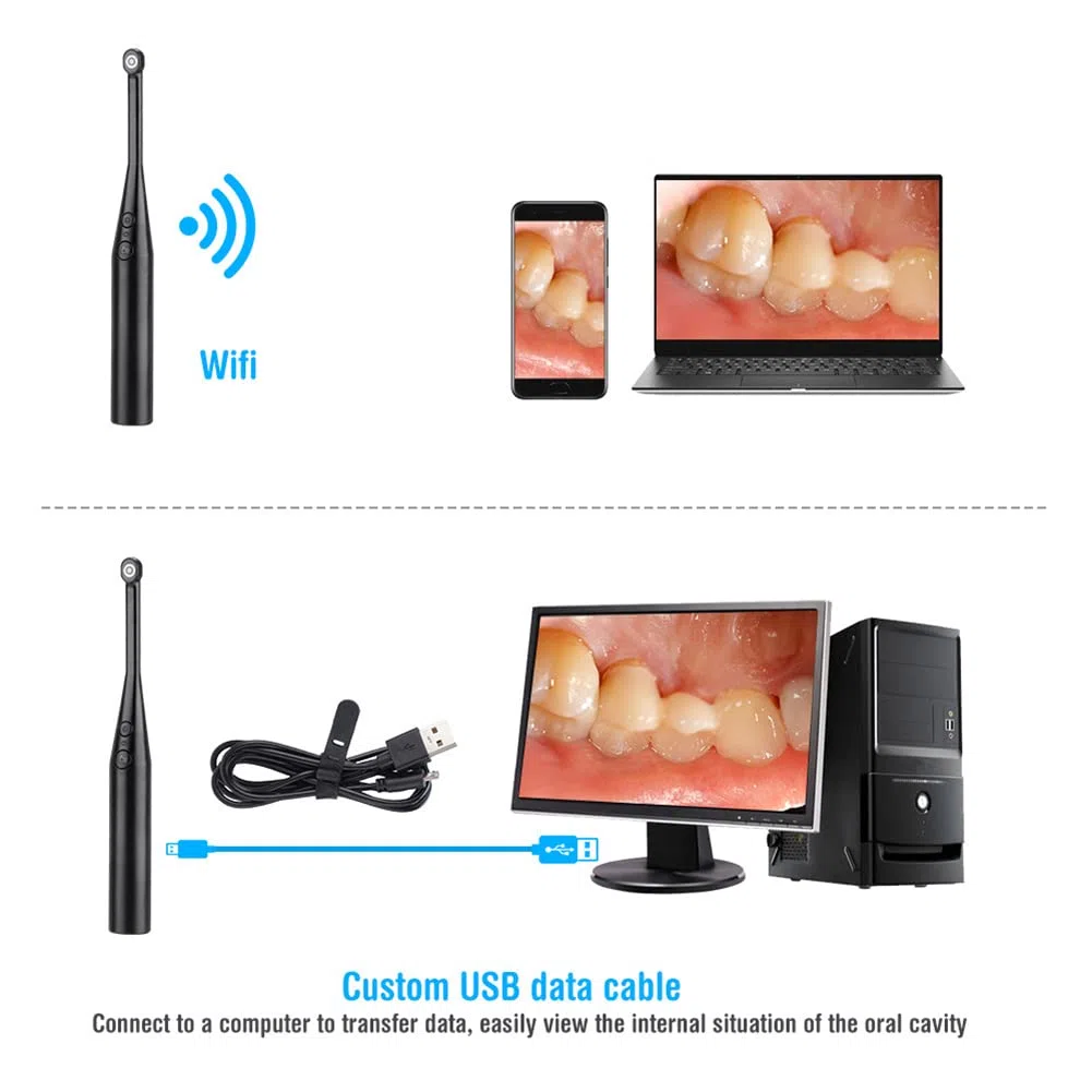 iksvmsis Cámara Intraoral Dental Cámara Oral Dental Cámara Endoscópica Endoscópica Intraoral WiFi Cámara con 8 Led USB De Endoscopio Dental Hogar Dentista Lupa Clínica Cámara